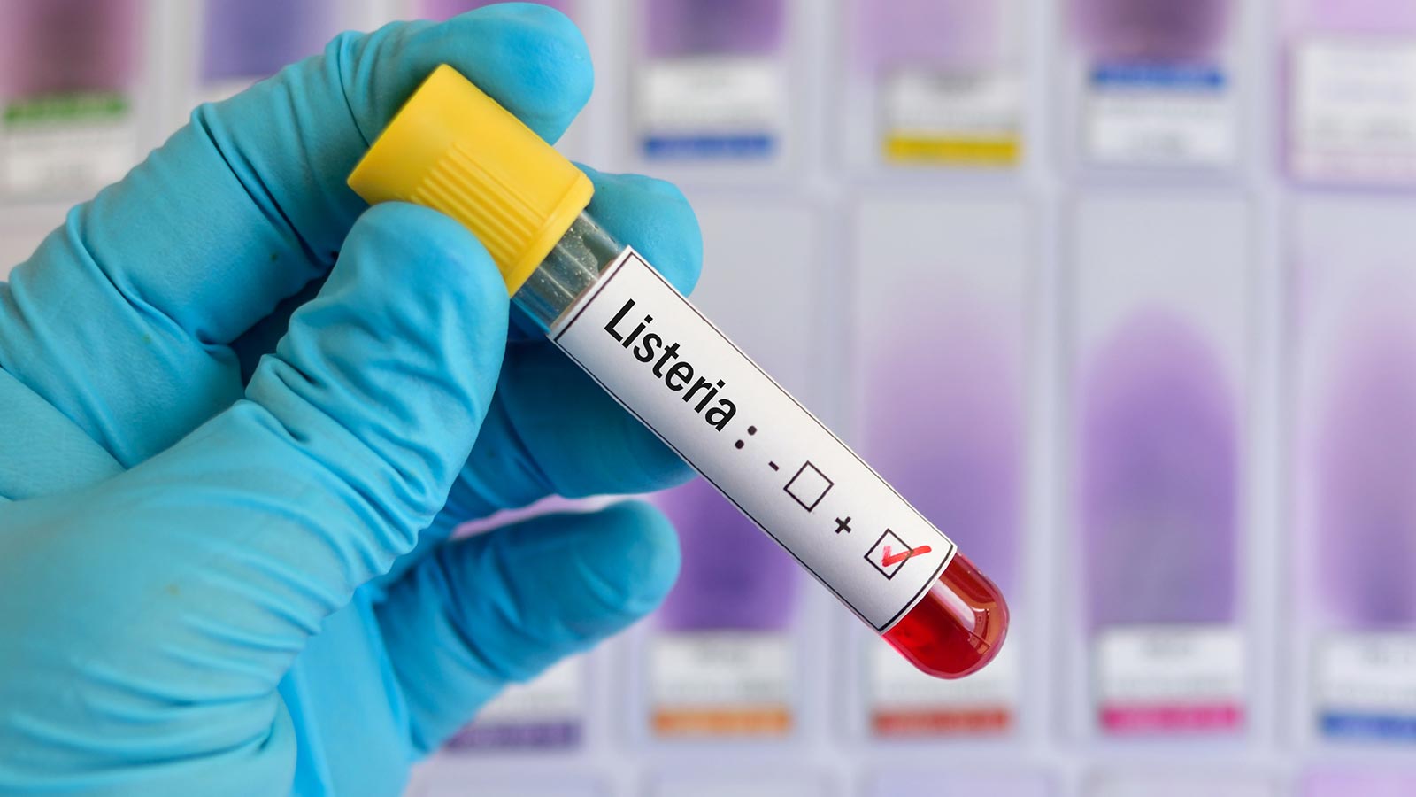 Intoxicación queso listeria